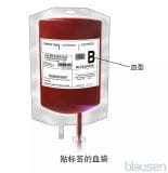 血浆