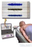 肌电图(EMG)和神经传导研究