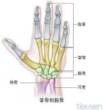 手和手指畸形
