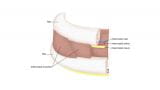 如何进行管导管胸腔造口术