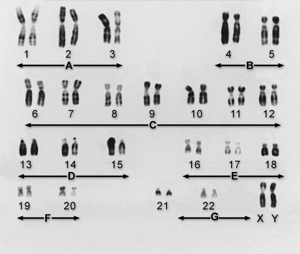 染色体组数图片