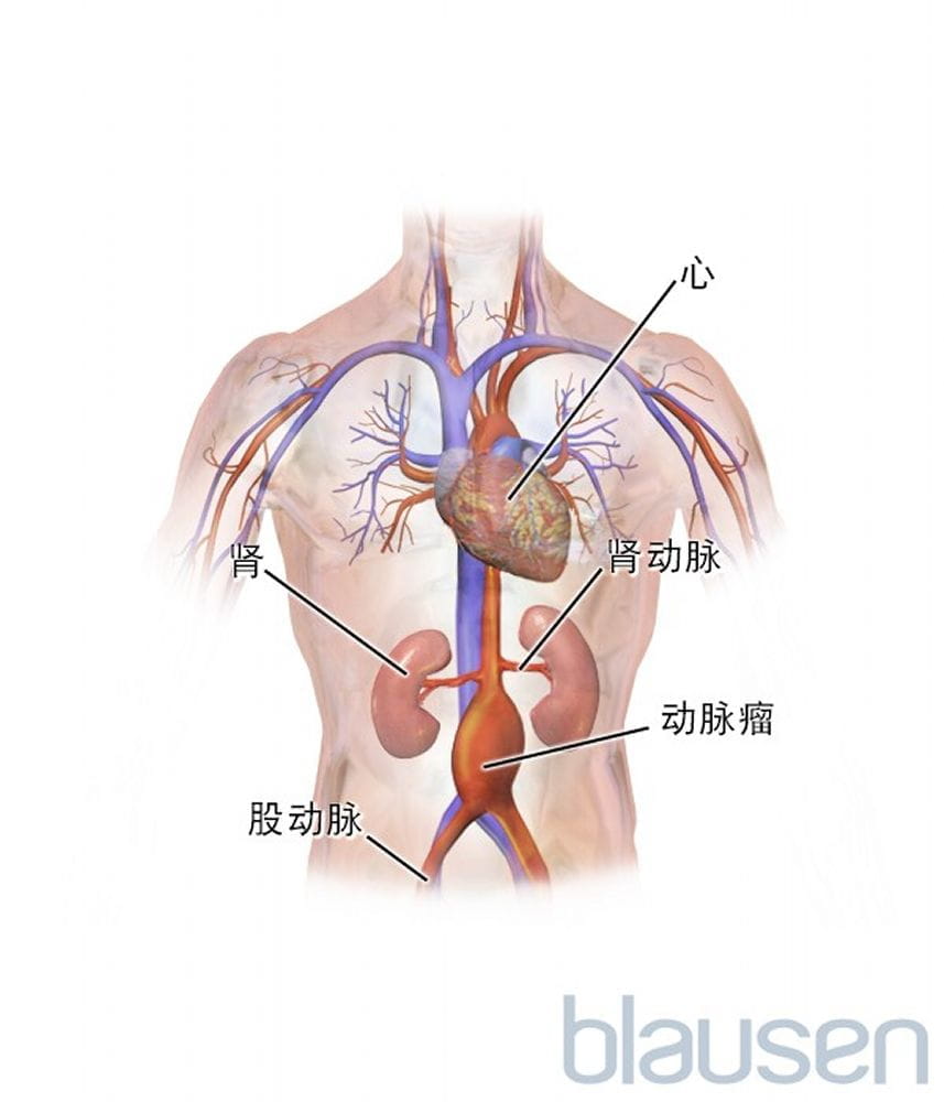 腹部主动脉的位置图图片