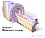 磁共振成像（MRI）