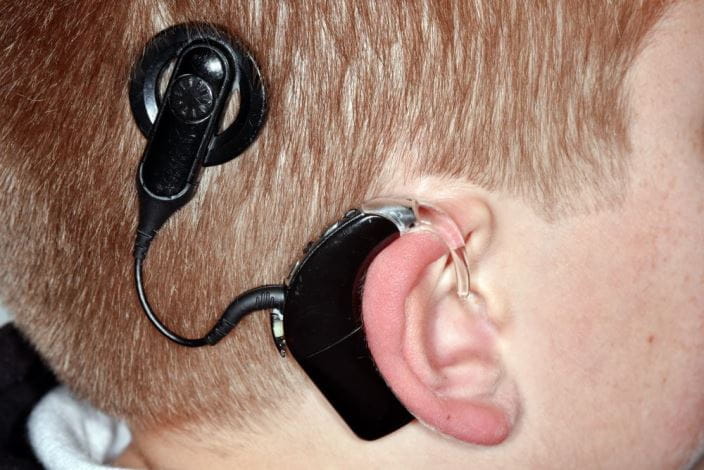c0269226-cochlear-implant-child-science-photo-library-high_zh