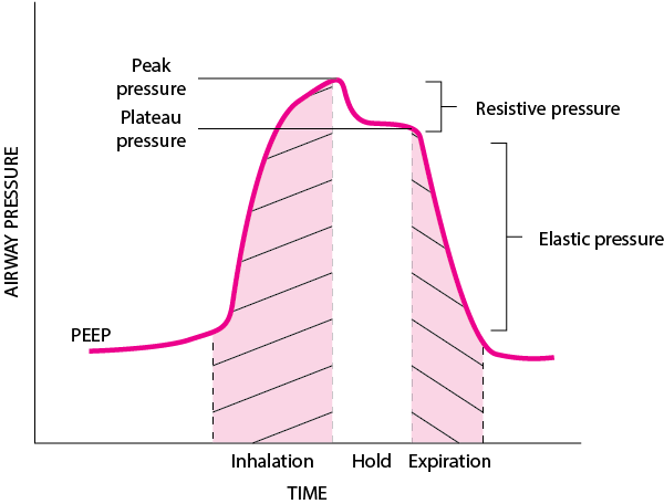 机械通气时气道压力的组成（吸气后屏气状态）