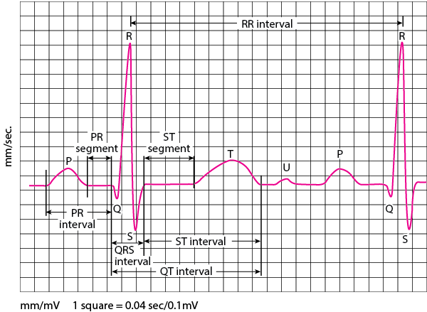 心电图 （ECG）波形