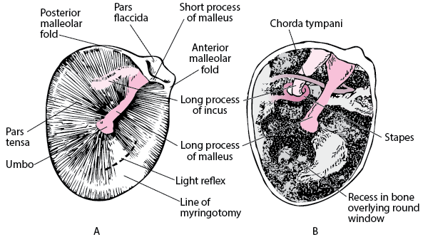 右耳鼓膜（A）；鼓膜去除后的鼓室腔（B）