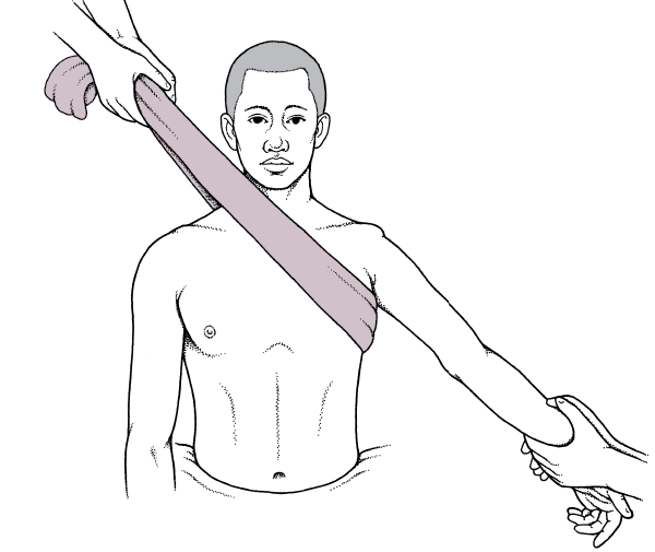 牵引-抗牵引技术用于肩关节前脱位的复位