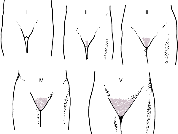 GYN_tanner_stages_pubic_hair_zh