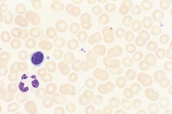Peripheral_blood_smear_normal_high_zh