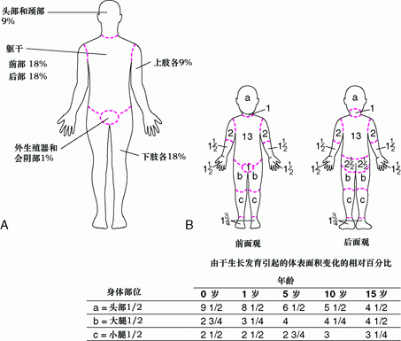 （A） 九分法（成人）和 （B） Lund-Browder表 （儿童） 估计烧伤面积