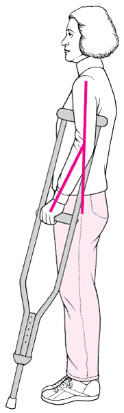 SPS_fitting_crutches_PE_zh
